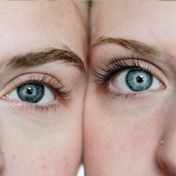 An image of the eyes signifying BCD onset.